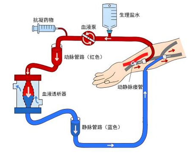最新！血液净化龙头冲刺IPO(图7)